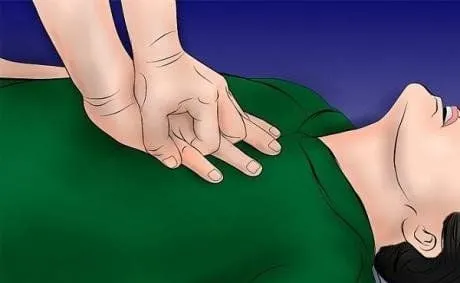 Hình ảnh minh họa phương pháp hô hấp nhân tạo kết hợp xoa bóp tim ngoài lồng ngực